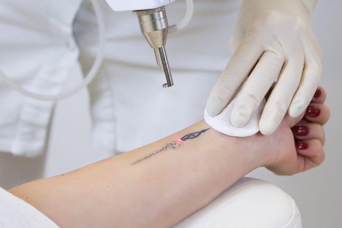 Skin Pigment Spots Lentigo Type Ribe Clinic